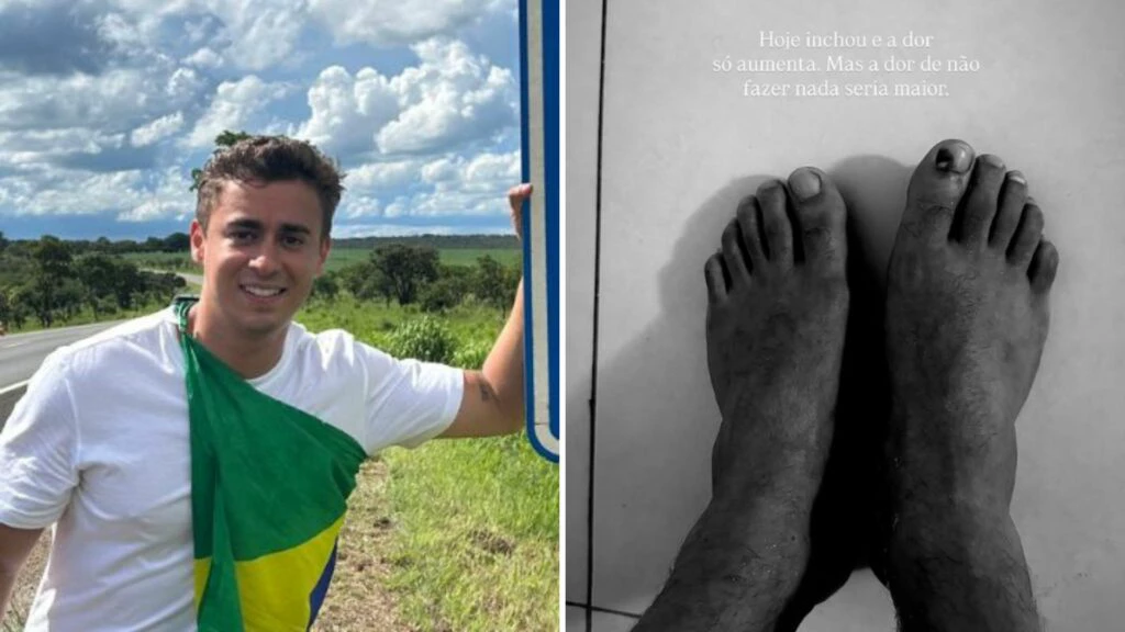 Nikolas expõe pés machucados em meio à caminhada de 230km